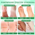 Aloes Żelowa Kąpiel do Stóp SPA KINOKI Pedicure Cleanse Foot Jelly 2w1